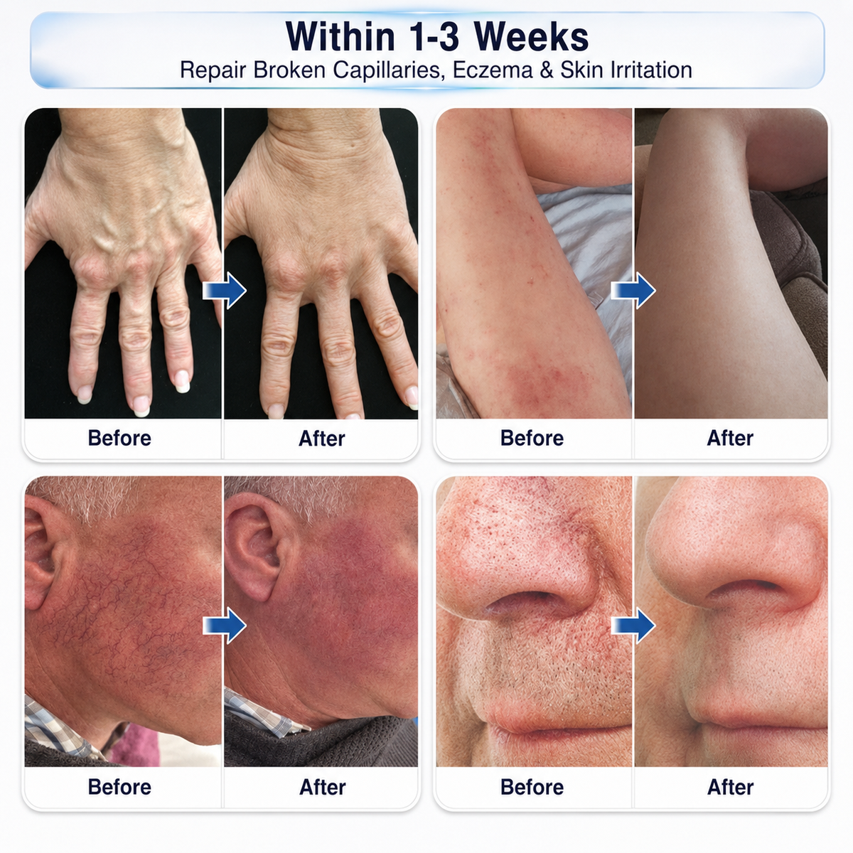 Consistency = Better Leg Care! 🦵✨Enjoy a limited-time 30% OFF 𝑯𝗲𝙖𝐥𝒓𝗶𝙯𝗲®! Many customers choose the 6-box bundle for a complete, consistent vein-care routine—while also locking in our best-value savings. Don’t miss out! 👍⏰